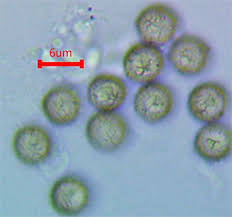 Attēlu rezultāti vaicājumam “Lycogala cf. fossiculatum”
