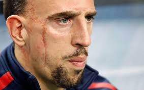 Image result for Ribery