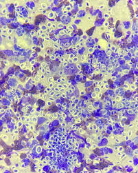 Attēlu rezultāti vaicājumam “Blepharostoma trichophyllum sporophyte”