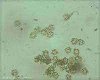 Attēlu rezultāti vaicājumam “Oligonema favogineum spores”