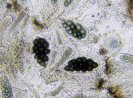 Attēlu rezultāti vaicājumam “Anaptychia ciliaris”