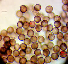 Attēlu rezultāti vaicājumam “Lycogala ustulatum macro”