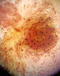 Attēlu rezultāti vaicājumam “Cribraria martinii spores”