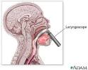 <b>Laryngoscope</b>