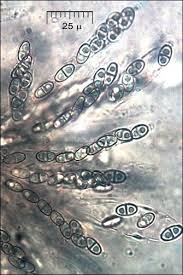 Attēlu rezultāti vaicājumam “Nectria peziza”