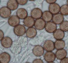 Attēlu rezultāti vaicājumam “Physarum obscurum spores”