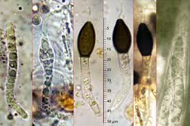 Attēlu rezultāti vaicājumam “Lasiosphaeria ovina spores”