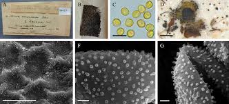Attēlu rezultāti vaicājumam “Perichaena corticalis spores”