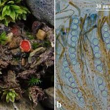 Attēlu rezultāti vaicājumam “Heterotrichia pomiformis (syn. Arcyria pomiformis) spores”