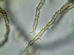 Attēlu rezultāti vaicājumam “Trichia contorta”