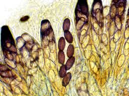 Attēlu rezultāti vaicājumam “Ascobolus furfuraceus”