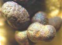 Attēlu rezultāti vaicājumam “Badhamia foliicola spores”