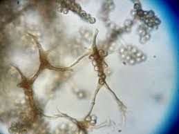 Attēlu rezultāti vaicājumam “Cribraria splendens”