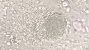 Attēlu rezultāti vaicājumam “Physarum nitens plasmodium”