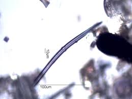 Attēlu rezultāti vaicājumam “Spongilla lacustris”