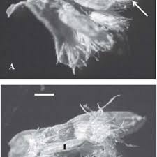 Attēlu rezultāti vaicājumam “Diachea subsessilis”