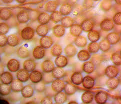 Attēlu rezultāti vaicājumam “Didymium xanthopus spores”