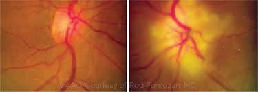 Image result for GCA