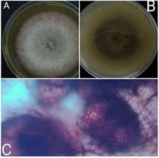 Attēlu rezultāti vaicājumam “Diderma globosum spores”