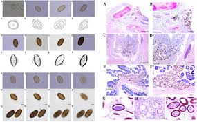 Attēlu rezultāti vaicājumam “Phronia sp. larva”