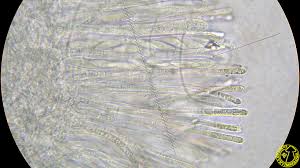 Attēlu rezultāti vaicājumam “Cudoniella acicularis”