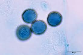 Attēlu rezultāti vaicājumam “Physarum cinereum spores”