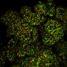 Attēlu rezultāti vaicājumam “Pseudobryum cinclidioides cells”