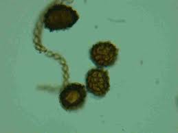 Attēlu rezultāti vaicājumam “Fossombronia foveolata sporophyte”