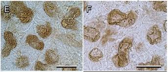 Attēlu rezultāti vaicājumam “Lycogala miserum”