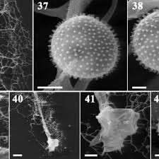 Attēlu rezultāti vaicājumam “Diderma montanum spores”