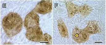 Attēlu rezultāti vaicājumam “Lycogala miserum”