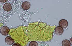 Attēlu rezultāti vaicājumam “Physarum contextum spores”