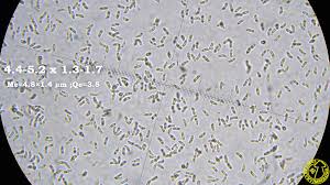 Attēlu rezultāti vaicājumam “Postia fragilis”
