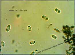 Attēlu rezultāti vaicājumam “Lichenoconium xanthoriae”