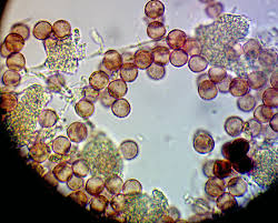 Attēlu rezultāti vaicājumam “Physarum bryomacrocarpum spores”