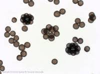 Attēlu rezultāti vaicājumam “Badhamia dubia spores”