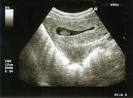 Mamme Domani | Ecografie