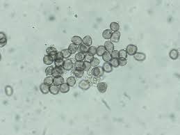 Attēlu rezultāti vaicājumam “Physarum notabile macro”