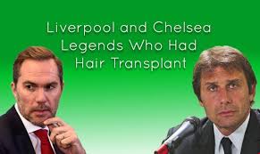 Image result for Liverpool Transplant FC