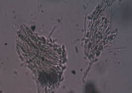 Attēlu rezultāti vaicājumam “Physarum bryocorticola sessile”