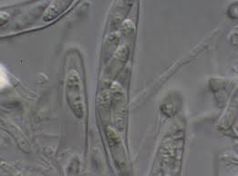 Attēlu rezultāti vaicājumam “Hyaloscypha hyalina”