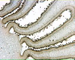 Attēlu rezultāti vaicājumam “Coprinus sp.”