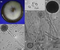 Attēlu rezultāti vaicājumam “Trichia alpina spores”