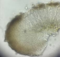 Attēlu rezultāti vaicājumam “Biatora sphaeroides”