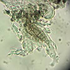 Attēlu rezultāti vaicājumam “Arthonia spadicea”