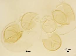 Attēlu rezultāti vaicājumam “Didymium aggregatum spores”