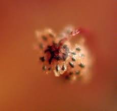 Attēlu rezultāti vaicājumam “Hemitrichia chrysospora young”