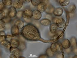 Attēlu rezultāti vaicājumam “Trichia contorta”