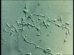 Attēlu rezultāti vaicājumam “Stemonitis flavogenita”