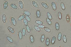 Attēlu rezultāti vaicājumam “Otidea bufonia”